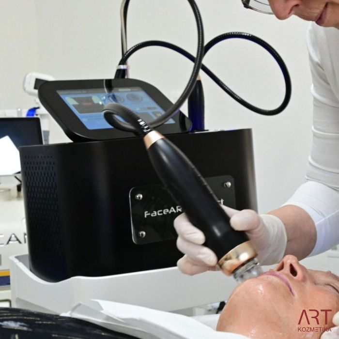 FaceART perfect -  napredna tehnologija za njegu lica - microneedling +RF + vacuum