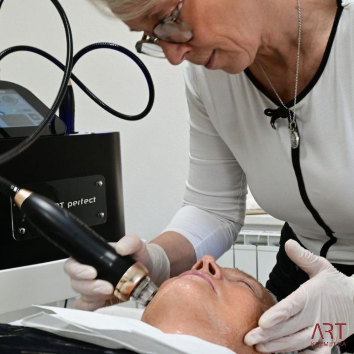 FaceART perfect -  napredna tehnologija za njegu lica - microneedling +RF + vacuum