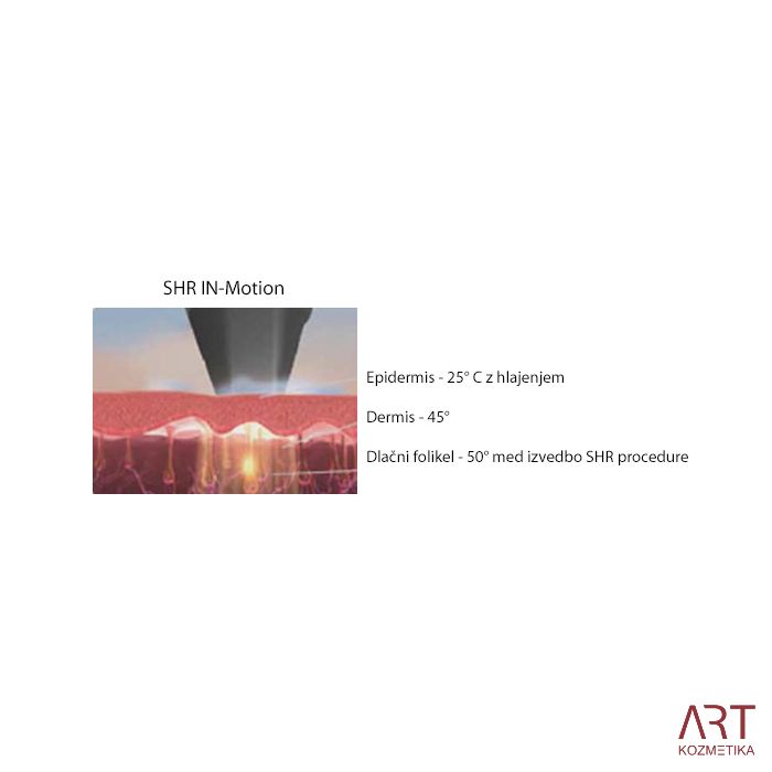 eLite Ana SHR IPL+RF