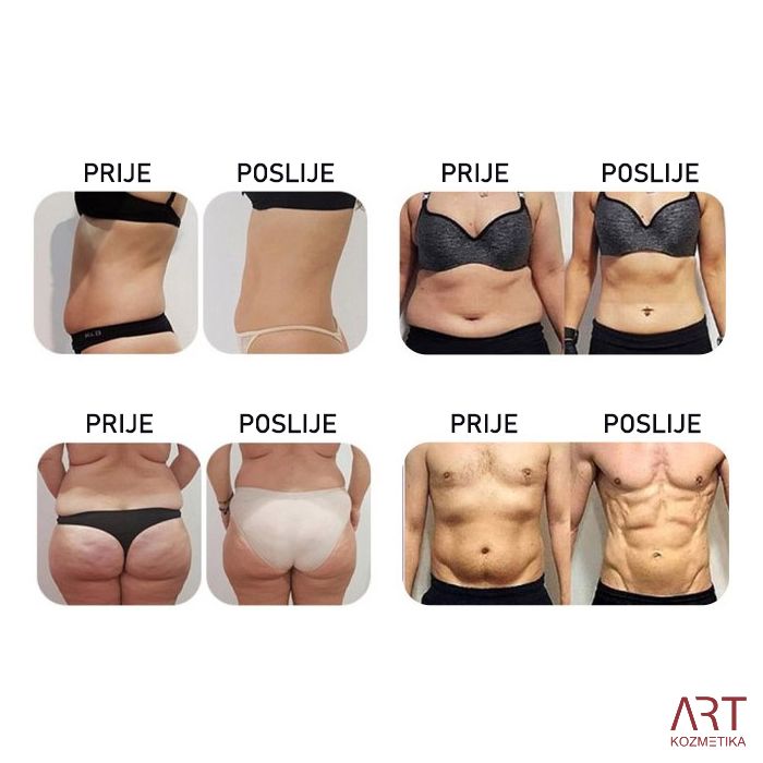 Elektromagnetni stimulacijski uređaj TeslaART - prijenosni mišićni stimulator za oblikovanje tijela