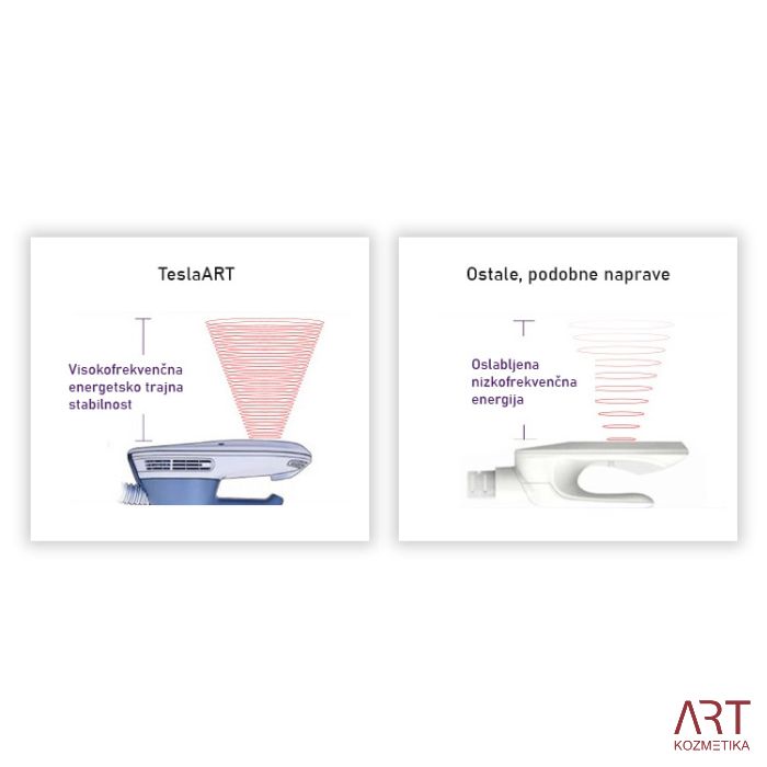 Elektromagnetni stimulacijski uređaj TeslaART - prijenosni mišićni stimulator za oblikovanje tijela