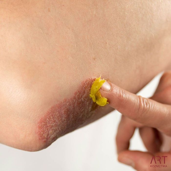 Krema za kožu - terapeutska | Hemptouch | 50ml