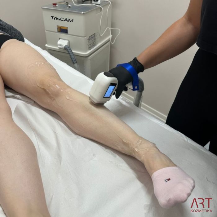 Diodni laser TrisCAM