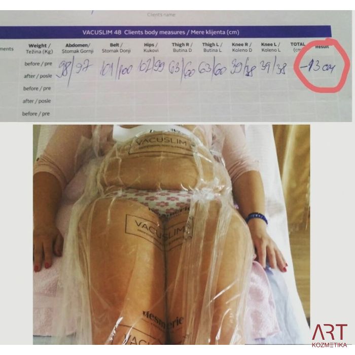 Vacuslim 48 tretma -  INDIVIDUALNO IZOBRAŽEVANJE