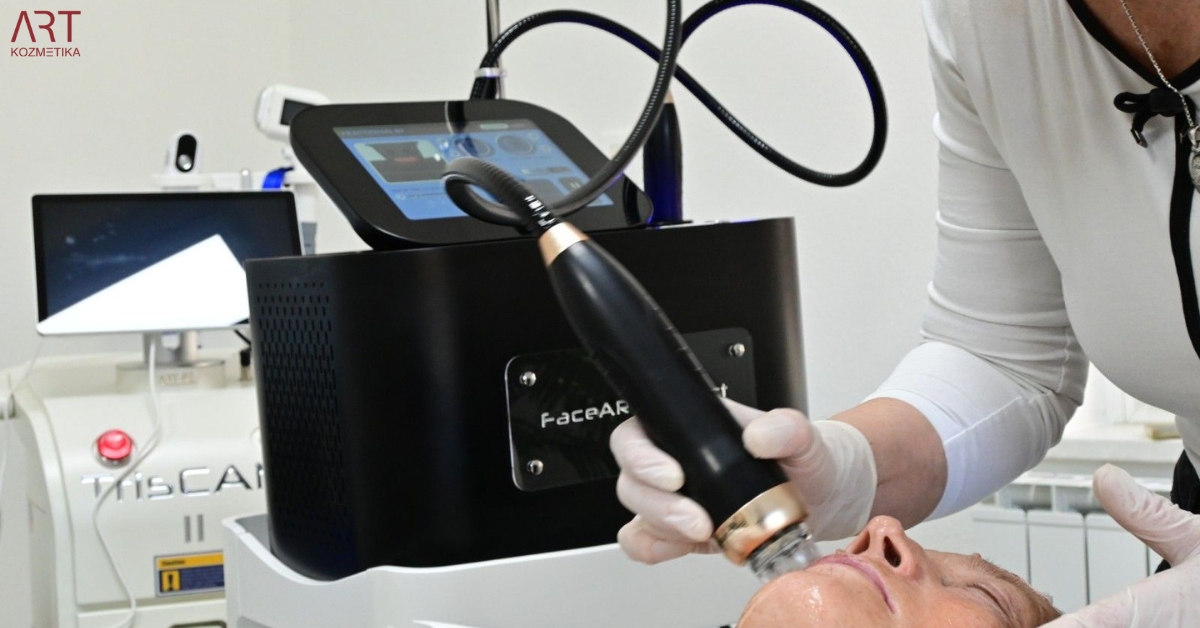 Iglična mezoterapija sa radiofrekvencijom: Revolucionarna metoda za pomlađivanje kože