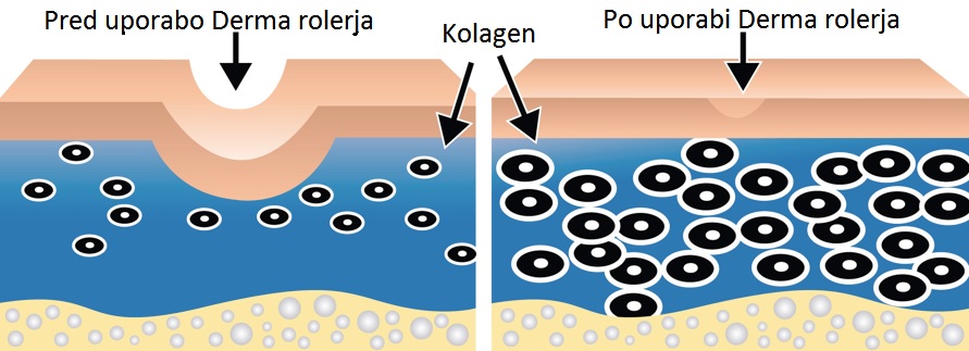 Derma roler Derma roler