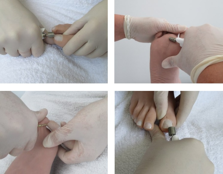 HADEWE MADEAS PLUS pedikerski aparat s funkcijo sesanja prikaz dela