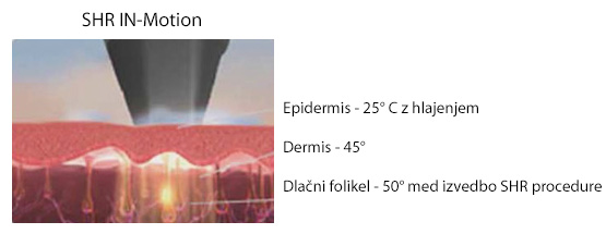 SHR IN motion SHR IN motion