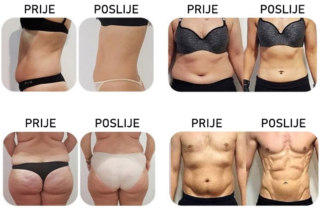 prije poslije prije poslije