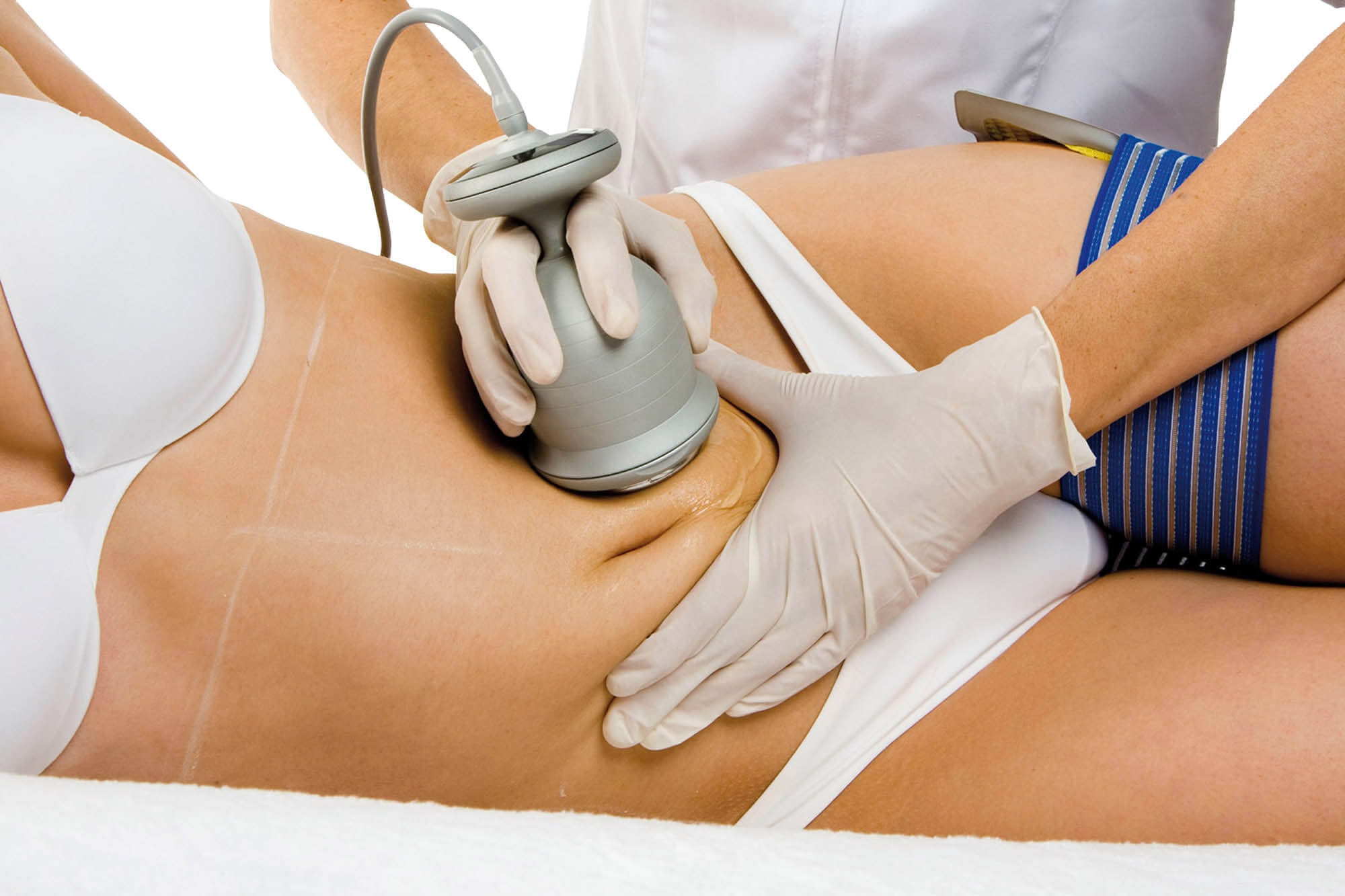 Vakuumska kavitacija  Vakuumska kavitacija