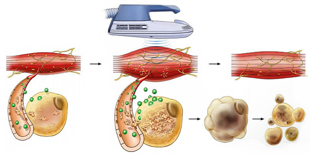 delovanje teslart delovanje teslart