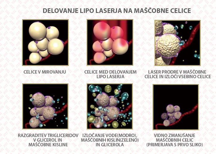 Delovanje Lipo LASERJA NA MAŠČOBNE CELICE Delovanje Lipo LASERJA NA MAŠČOBNE CELICE