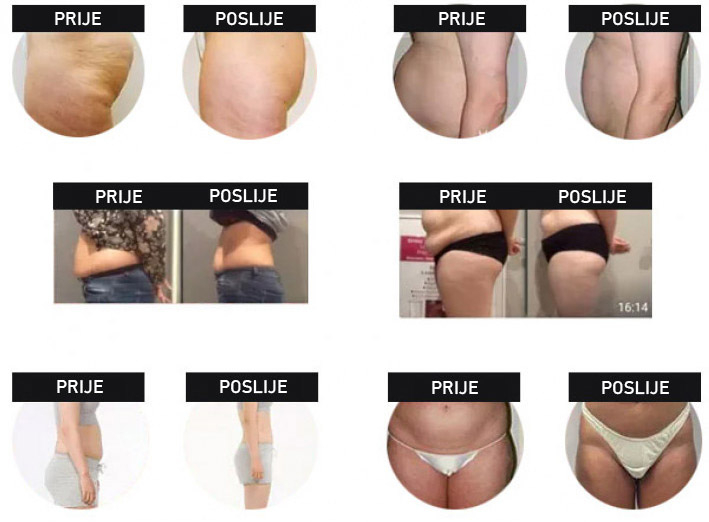 prije poslije prije poslije