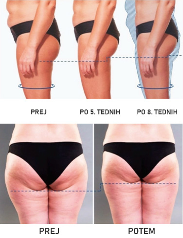 prej potem TeslaART plus prej potem TeslaART plus
